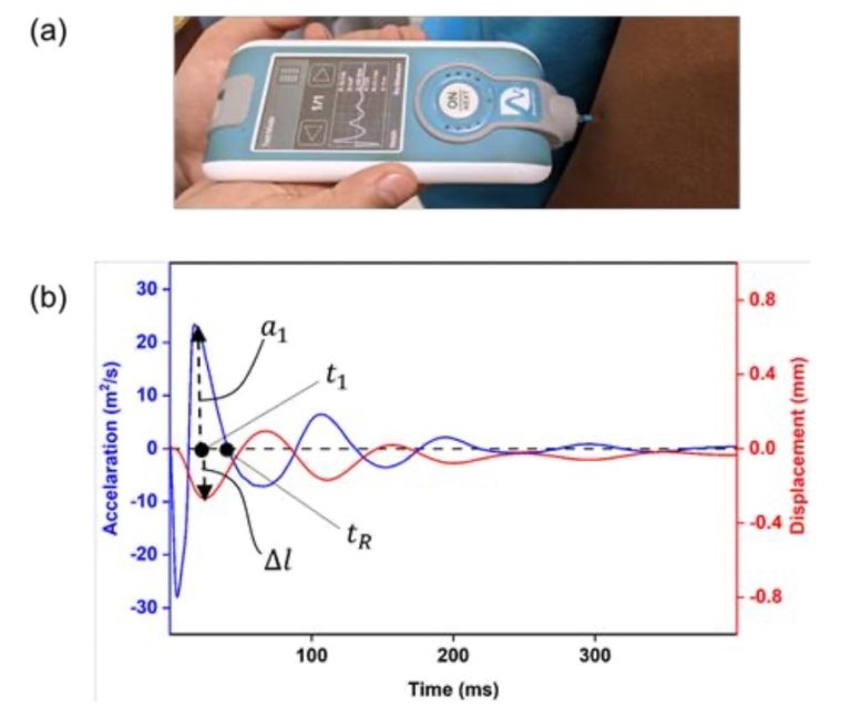 Influence Of Viscoelasticity On Dynamic Fatiguing Behavior Of Muscle ...